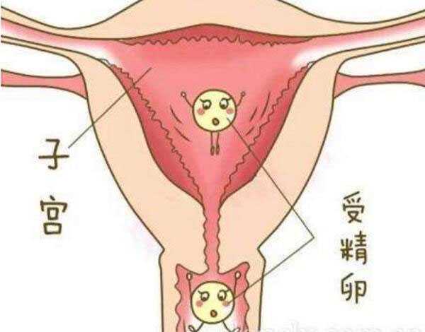 助孕去哪里好_中国高端助孕网_泰国试管婴儿可以科学避免生化妊娠吗?
